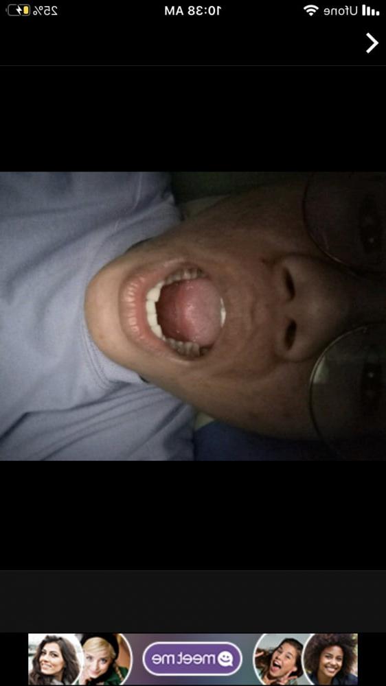13P Skout