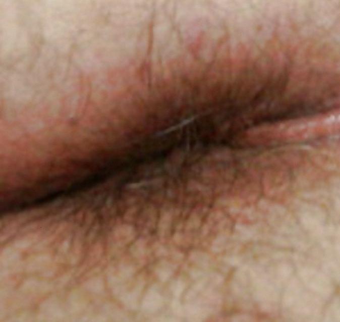 25P ASSES AND ASS 