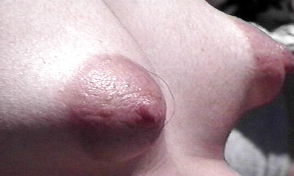 20P Puffy nips 3