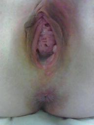 25P EX Girlfriend Sexting Photos.  Pussy Close Up.  Creampie!