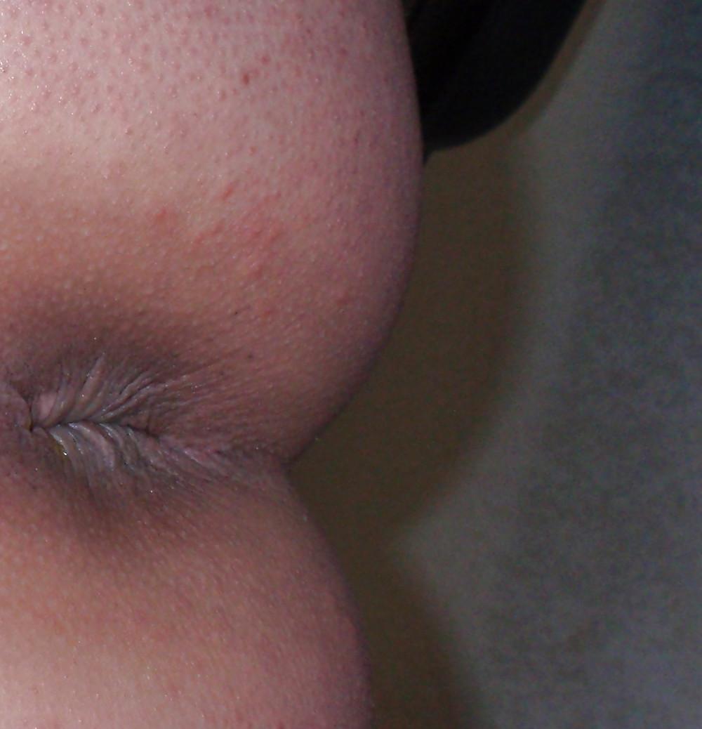 15P My teen butt and butthole