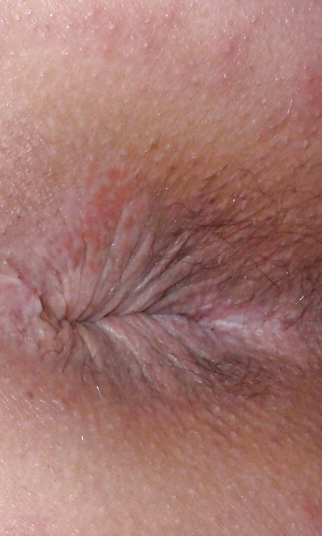 15P My teen butt and butthole