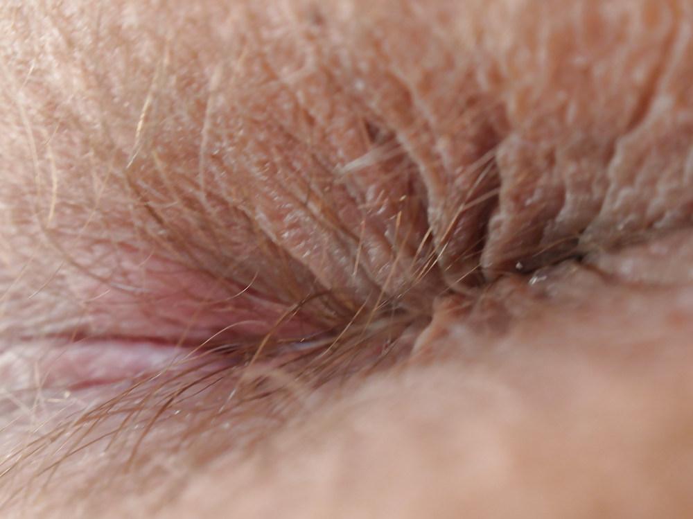 15P My teen butt and butthole