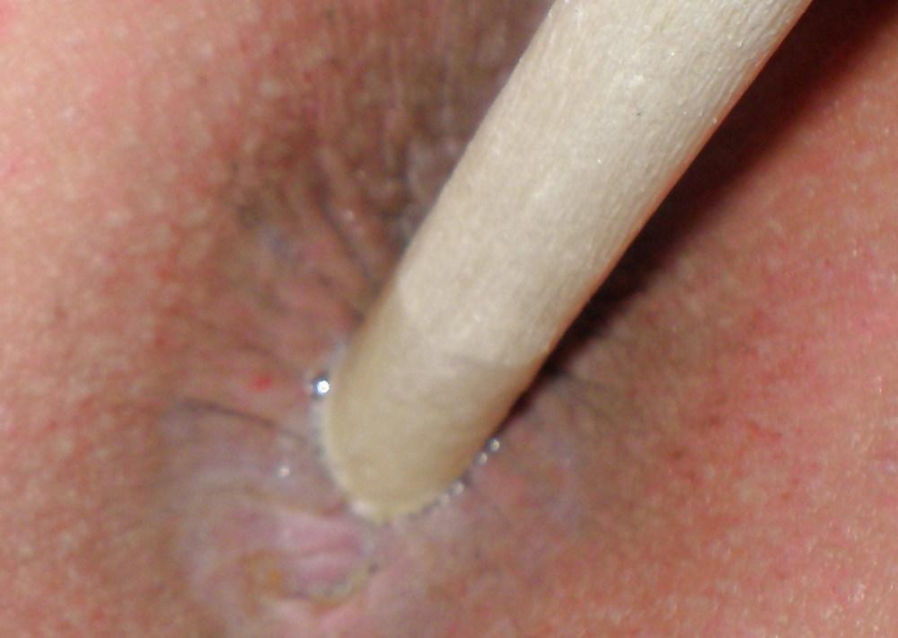 15P My teen butt and butthole