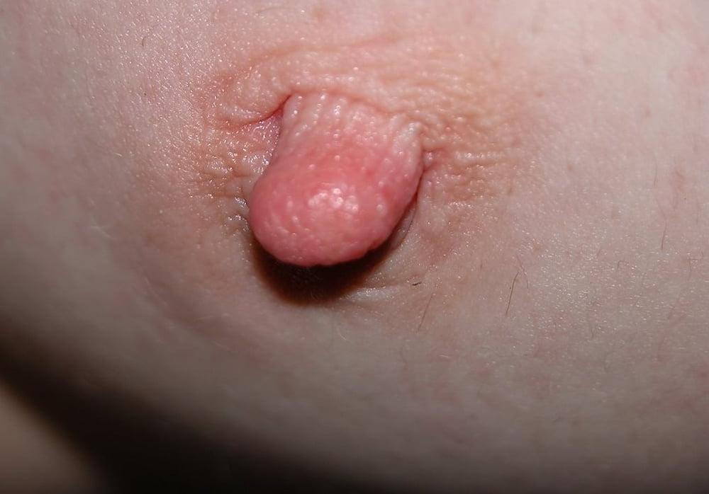 25P Nipples