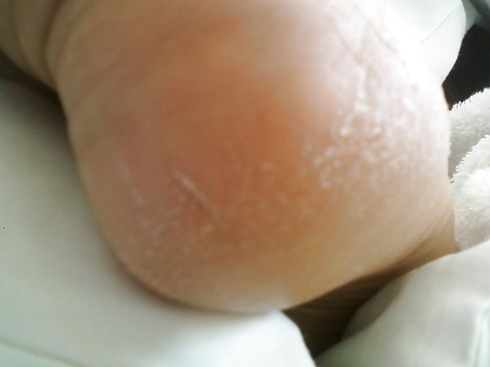 25P Venezuelan sexy feet