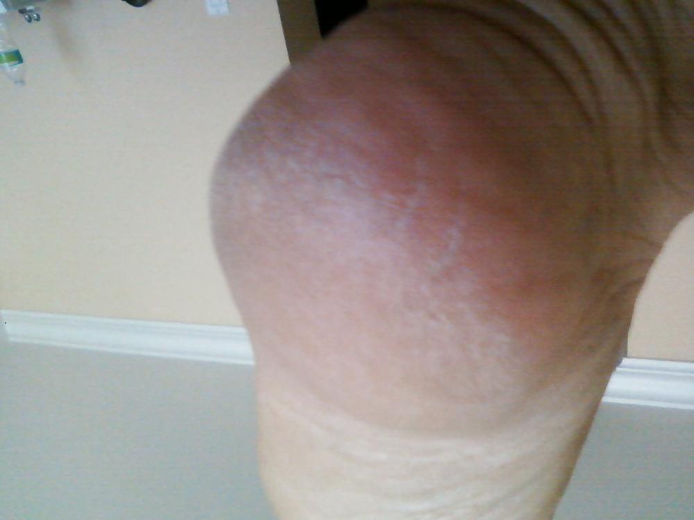 25P Venezuelan sexy feet
