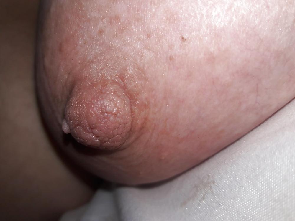 25P NIPPLES 00