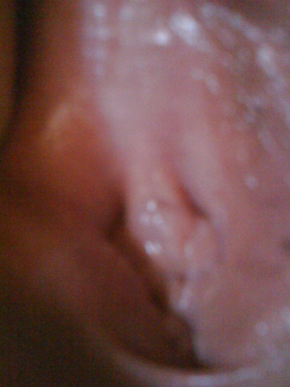 14P Ich