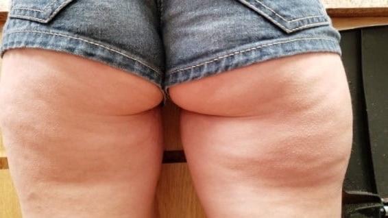 25P Thick, White and Cellulite 133