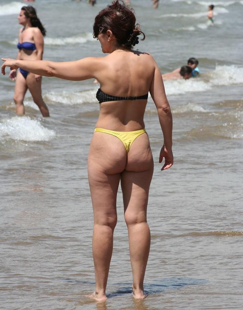25P Thick, White and Cellulite 132