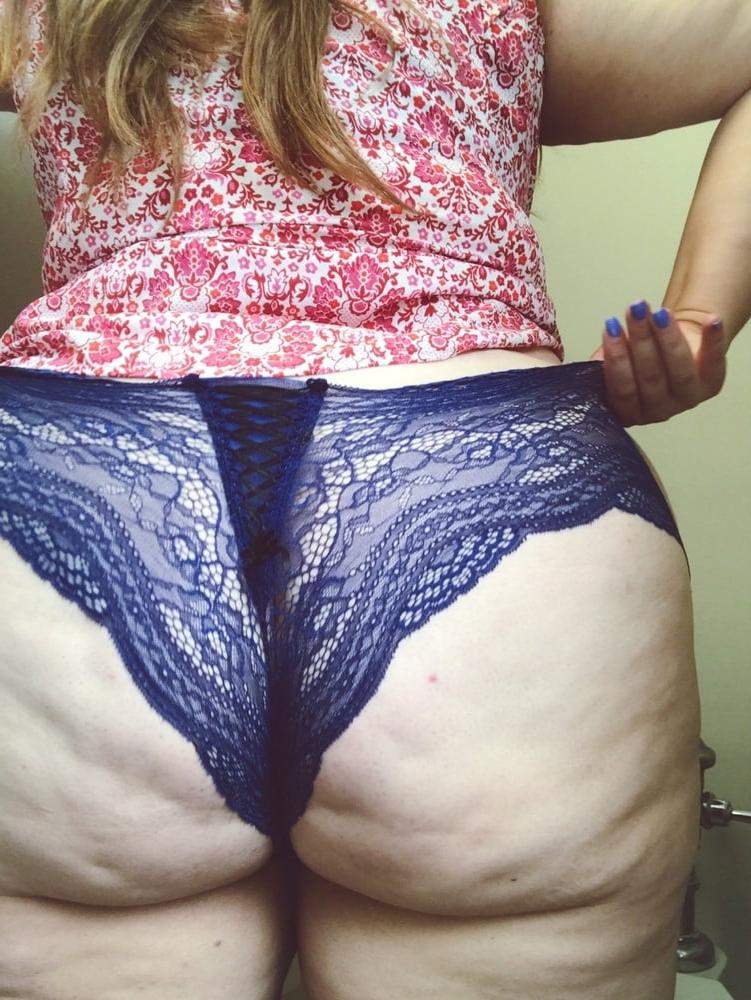 25P Thick, White and Cellulite 132