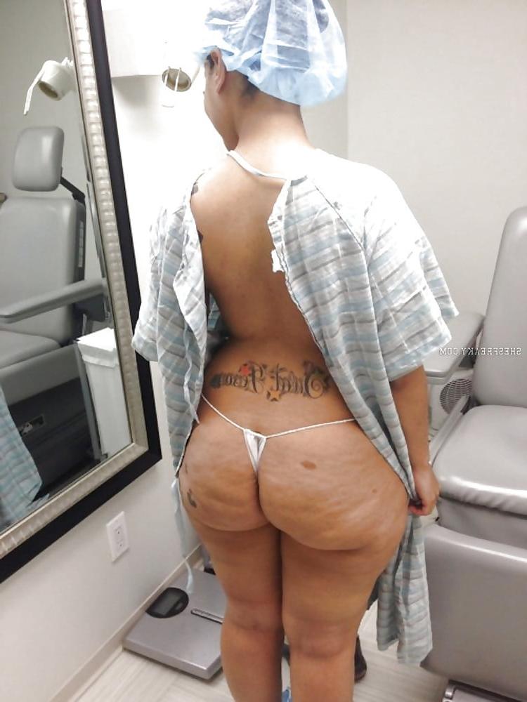 25P Thick, White and Cellulite 136