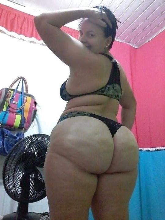 25P Thick, White and Cellulite 134