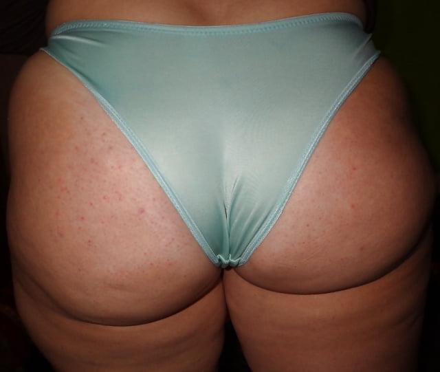 25P Thick, White and Cellulite 134