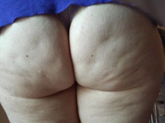 25P Thick, White and Cellulite 134