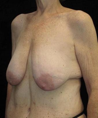 25P Saggy tits vol 6