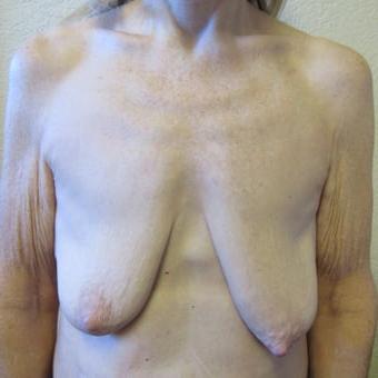 25P Saggy tits vol 6