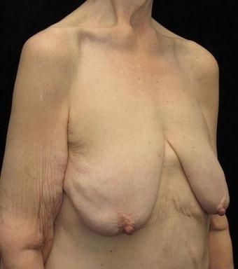 25P Saggy tits vol 6