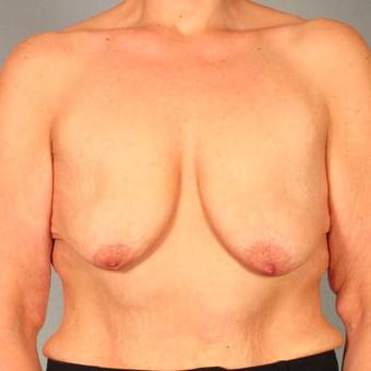 25P Saggy tits vol 6