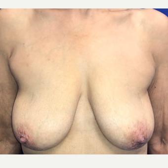 25P Saggy tits vol 6