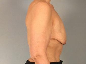 25P Saggy tits vol 6