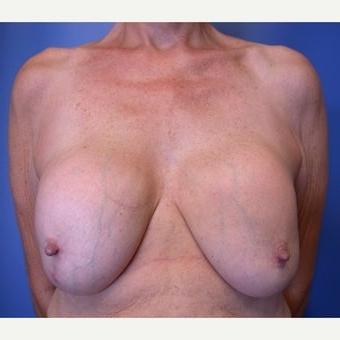25P Saggy tits vol 6