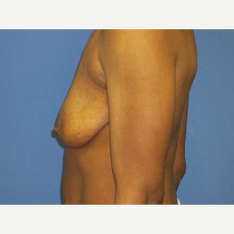 25P Saggy tits vol 6