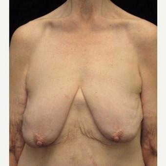 25P Saggy tits vol 6