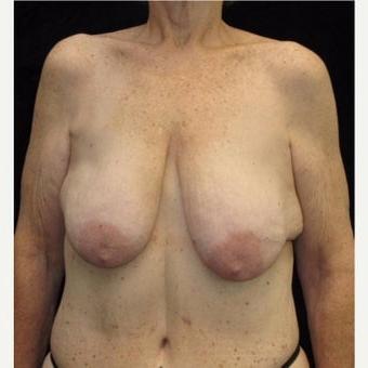 25P Saggy tits vol 6