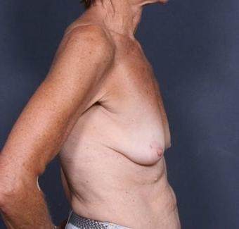 25P Saggy tits vol 6