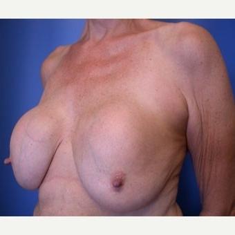 25P Saggy tits vol 6