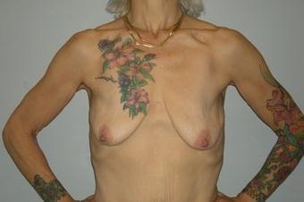 25P Saggy tits vol 6