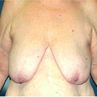 25P Saggy tits vol 6