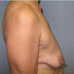 25P Saggy tits vol 6