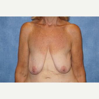 25P Saggy tits vol 6