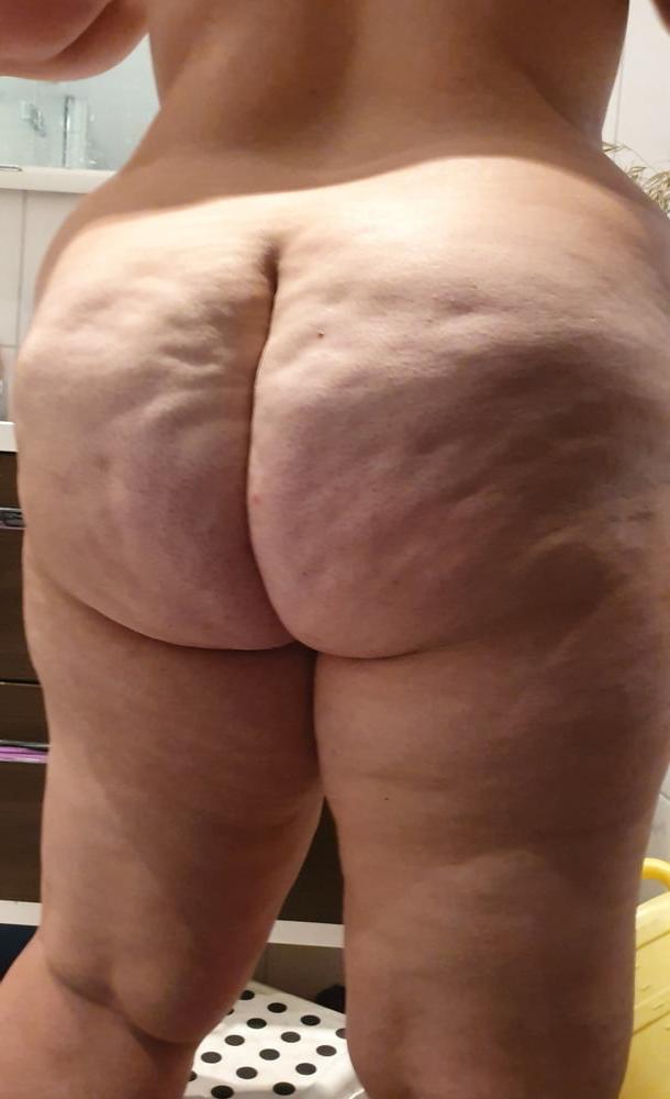 25P Thick, White and Cellulite 125