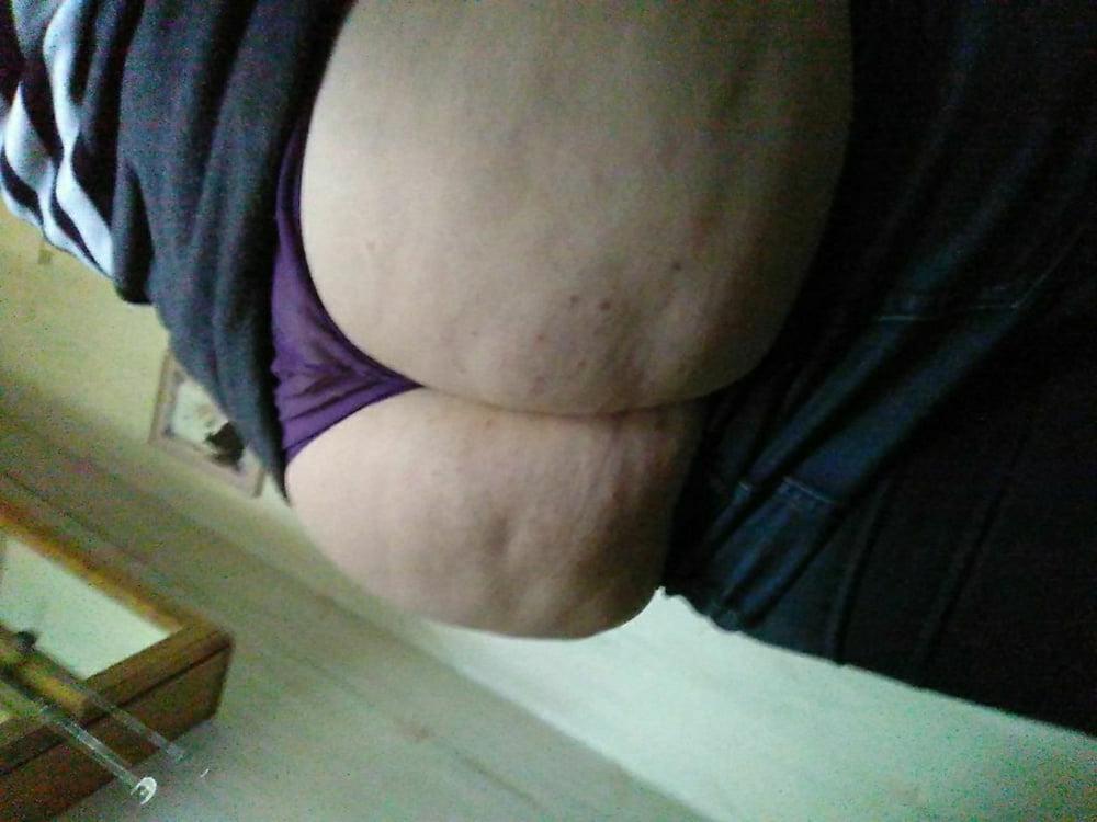 25P Thick, White and Cellulite 125