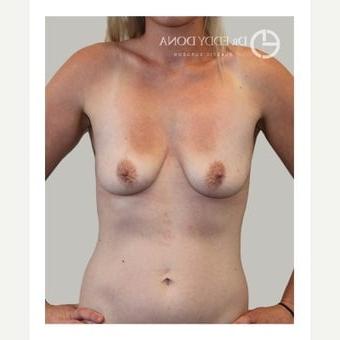 25P Saggy tits vol 5