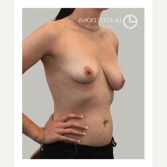 25P Saggy tits vol 5