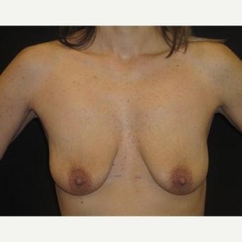 25P Saggy tits vol 5
