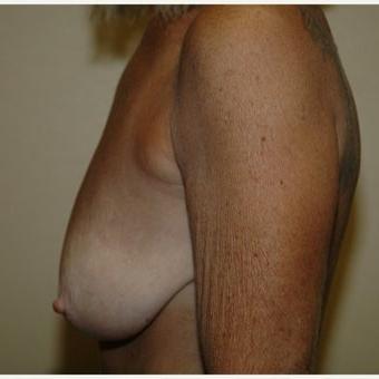 25P Saggy tits vol 5