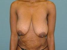 25P Saggy tits vol 5