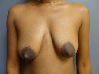 25P Saggy tits vol 5