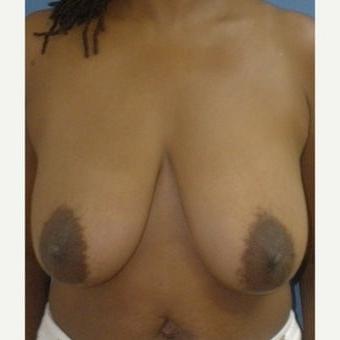25P Saggy tits vol 5