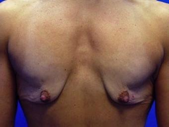 25P Saggy tits vol 5