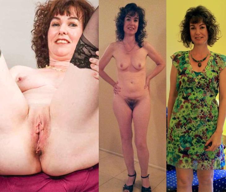 25P D &amp; U 35 bush and bald exposed