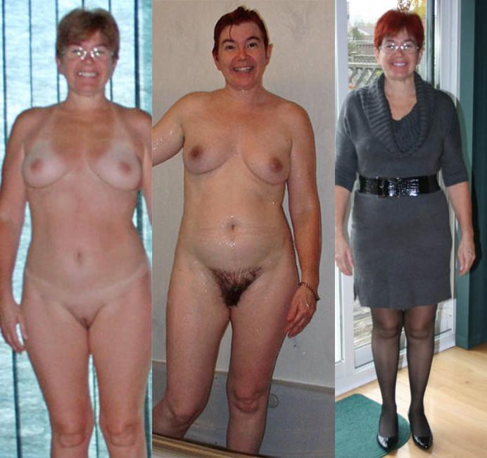 25P D &amp; U 35 bush and bald exposed