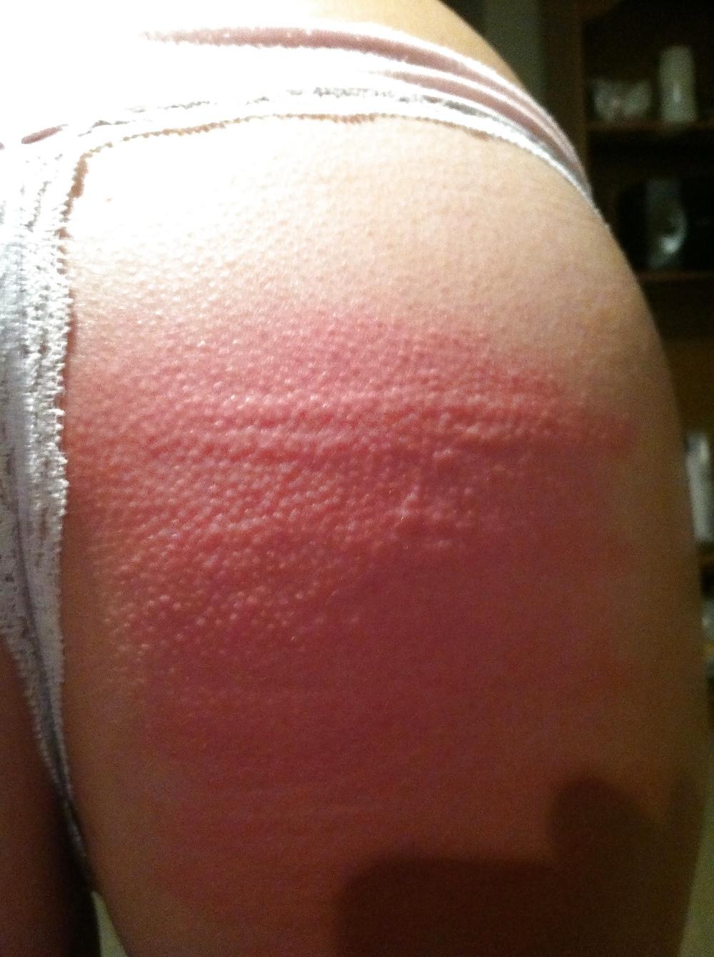 18P First Time with the cane