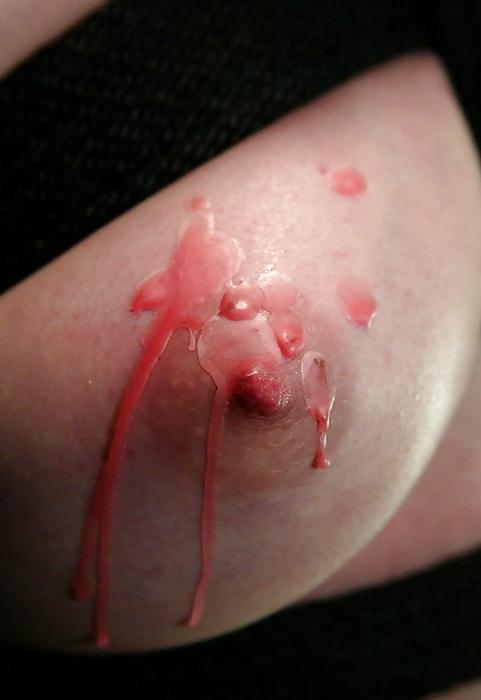 15P Found: bdsm 5 (nipple treats)